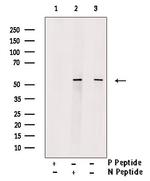 Phospho-N-WASP (Tyr256) Antibody in Western Blot (WB)