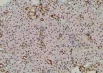 Phospho-CDK20 (Thr161) Antibody in Immunohistochemistry (Paraffin) (IHC (P))