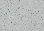 Phospho-CDK20 (Thr161) Antibody in Immunohistochemistry (Paraffin) (IHC (P))