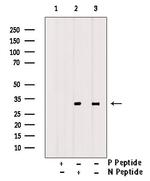 Phospho-CDK20 (Thr161) Antibody in Western Blot (WB)