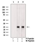 Phospho-HPRT1 (Ser110) Antibody in Western Blot (WB)
