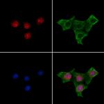 Phospho-MYOD (Thr115) Antibody in Immunocytochemistry (ICC/IF)