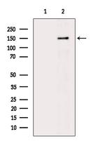 Phospho-AS160 (Ser570) Antibody in Western Blot (WB)