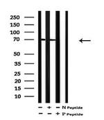 Phospho-PAK3 (Ser186) Antibody in Western Blot (WB)