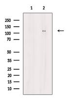 Phospho-E-cadherin (Tyr754) Antibody in Western Blot (WB)