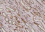 Phospho-E-cadherin (Tyr754) Antibody in Immunohistochemistry (Paraffin) (IHC (P))