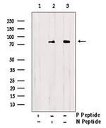 Phospho-HCLS1 (Tyr198) Antibody in Western Blot (WB)