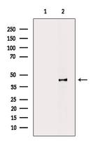 Phospho-p47phox (Ser304) Antibody in Western Blot (WB)