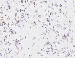 Phospho-EIF4B (Thr420) Antibody in Immunohistochemistry (Paraffin) (IHC (P))