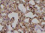 Phospho-EphA2 (Tyr588) Antibody in Immunohistochemistry (Paraffin) (IHC (P))