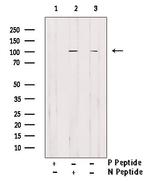 Phospho-EphA2 (Tyr594) Antibody in Western Blot (WB)