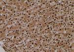 Phospho-TYK2 (Tyr433) Antibody in Immunohistochemistry (Paraffin) (IHC (P))