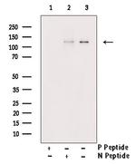 Phospho-TYK2 (Tyr433) Antibody in Western Blot (WB)