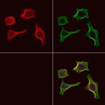 Phospho-CaMKII alpha/beta/delta (Ser235) Antibody in Immunocytochemistry (ICC/IF)