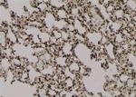 Phospho-EZH2 (Thr487) Antibody in Immunohistochemistry (Paraffin) (IHC (P))