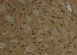 Phospho-EZH2 (Ser363, Ser366) Antibody in Immunohistochemistry (Paraffin) (IHC (P))