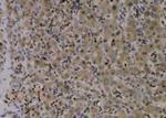 Phospho-TBC1D1 (Ser627) Antibody in Immunohistochemistry (Paraffin) (IHC (P))