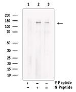 Phospho-TBC1D1 (Ser627) Antibody in Western Blot (WB)