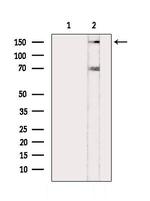 Phospho-BCL9L (Ser21 ) Antibody in Western Blot (WB)