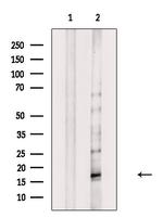 Phospho-MYL9 (Thr19, Ser20) Antibody in Western Blot (WB)