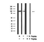 Phospho-NFATC2 (Ser326) Antibody in Western Blot (WB)