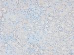 Phospho-HSL (Ser660) Antibody in Immunohistochemistry (Paraffin) (IHC (P))