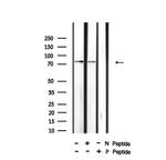 Phospho-HSL (Ser660) Antibody in Western Blot (WB)