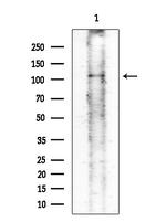Phospho-FES (Tyr713) Antibody in Western Blot (WB)