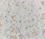 Phospho-HSF1 (Ser307) Antibody in Immunohistochemistry (Paraffin) (IHC (P))