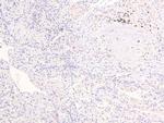 Phospho-KIF1C (Ser1092) Antibody in Immunohistochemistry (Paraffin) (IHC (P))