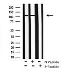 Phospho-KIF1C (Ser1092) Antibody in Western Blot (WB)