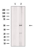 Phospho-PSEN2 (Ser330) Antibody in Western Blot (WB)