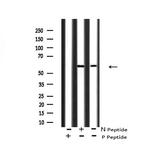 Phospho-FGR (Tyr412) Antibody in Western Blot (WB)