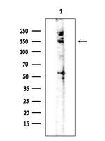 Phospho-HIPK1/HIPK2/HIPK3 (Tyr352, Tyr361, Tyr359) Antibody in Western Blot (WB)