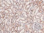 Phospho-HIPK1/HIPK2/HIPK3 (Tyr352, Tyr361, Tyr359) Antibody in Immunohistochemistry (Paraffin) (IHC (P))