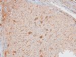 Phospho-IKK epsilon (Ser172) Antibody in Immunohistochemistry (Paraffin) (IHC (P))