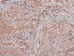 Phospho-MNK1 (Thr250) Antibody in Immunohistochemistry (Paraffin) (IHC (P))