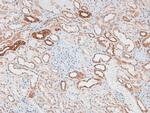 Phospho-p70 S6 Kinase (Ser427) Antibody in Immunohistochemistry (Paraffin) (IHC (P))