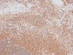 Phospho-p70 S6 Kinase (Ser427) Antibody in Immunohistochemistry (Paraffin) (IHC (P))