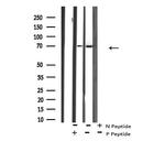 Phospho-p70 S6 Kinase (Ser427) Antibody in Western Blot (WB)