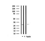 Phospho-LAT (Tyr161) Antibody in Western Blot (WB)