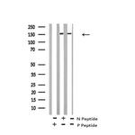Phospho-RET (Tyr1015) Antibody in Western Blot (WB)