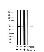 Phospho-RARA/RARB (Ser96) Antibody in Western Blot (WB)