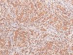 Phospho-CD22 (Tyr842) Antibody in Immunohistochemistry (Paraffin) (IHC (P))