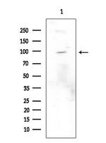 Phospho-Leptin Receptor (Tyr986) Antibody in Western Blot (WB)