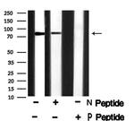 Phospho-RAD17 (Ser646) Antibody in Western Blot (WB)