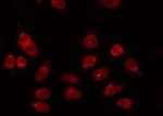 Phospho-SRF (Thr159) Antibody in Immunocytochemistry (ICC/IF)