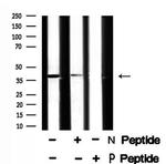 Phospho-XRCC4 (Ser260) Antibody in Western Blot (WB)