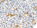 Phospho-TSC2 (Ser1254) Antibody in Immunohistochemistry (Paraffin) (IHC (P))