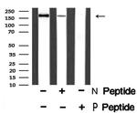 Phospho-ErbB4 (Tyr1056) Antibody in Western Blot (WB)